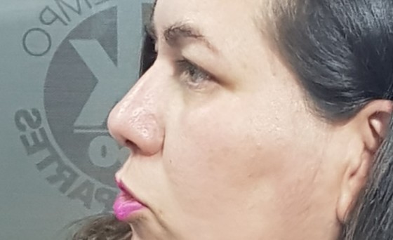 Autoridades no escuchan ni atienden a enfermos renales de Poncitlán: Laura Beatriz Chávez, comisionada ciudadana de Atención a Víctimas